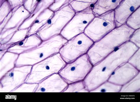 how are lettuce epidermal cells similar to onion cells